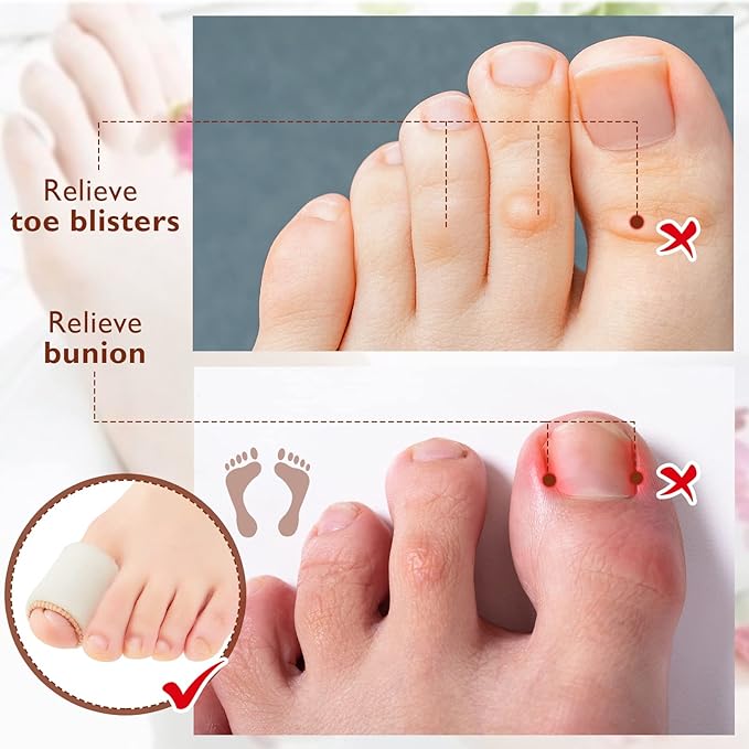 Tondiamo 6 Pieces Foam Toe Protector Sleeves Foam Bandages Tube Toe Cushion for Feet, Bunion, Hammer, Callus Corn, Bliste, Pain Relief(Large,Beige)